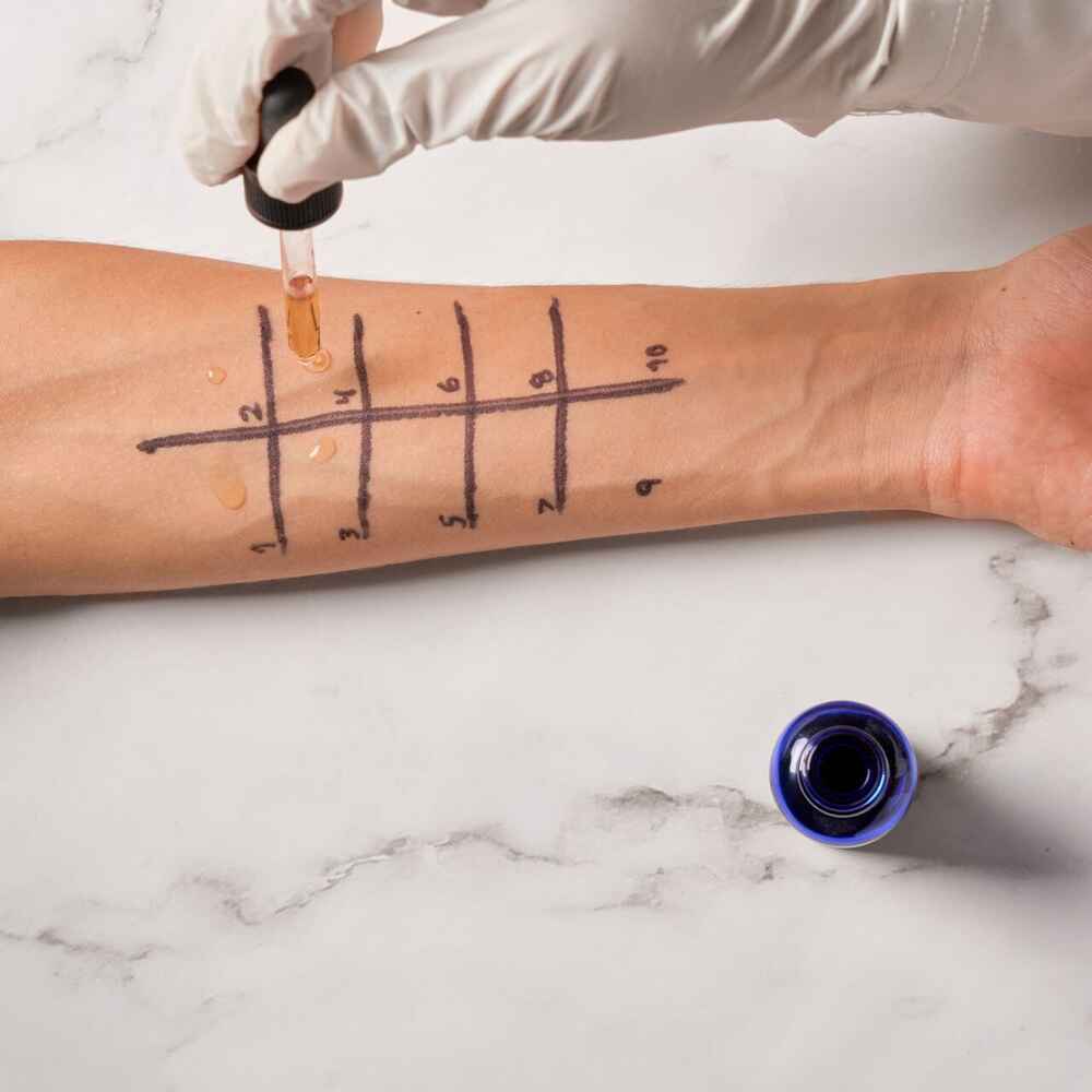 ENT doctor doing allergy testing on patient's arm
